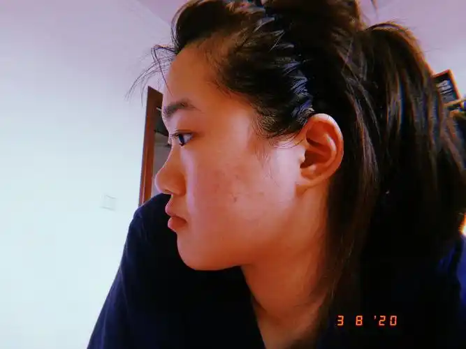 求助!我的致命侧脸还有救吗?