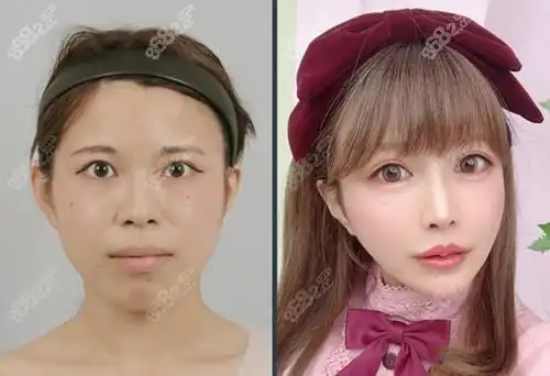 韩国人认可的整容医院有这几家,都是韩国有名气的整形医院!