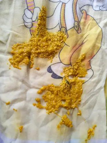 请问新生儿27天,每次拉的粑粑都是这样的有奶瓣,请问这样正常吗?