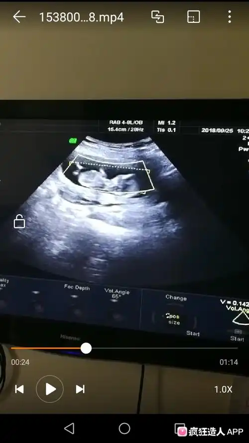 nt帮忙看下到底男孩女孩