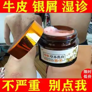 【特价】牛皮银屑病软膏特效老偏方专用药皮肤药膏外用膏藓癣中药