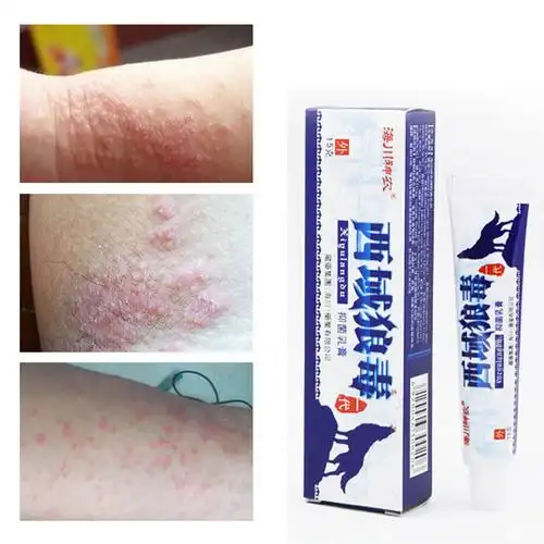 西域狼毒软膏股藓膏大腿内侧肛门阴囊脚藓止痒膏皮肤草本抑菌乳膏