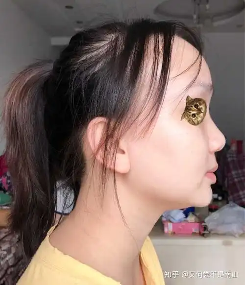 不是我吹啊! 我感觉没有人比我的侧脸更丑! 脑门大且凸出!