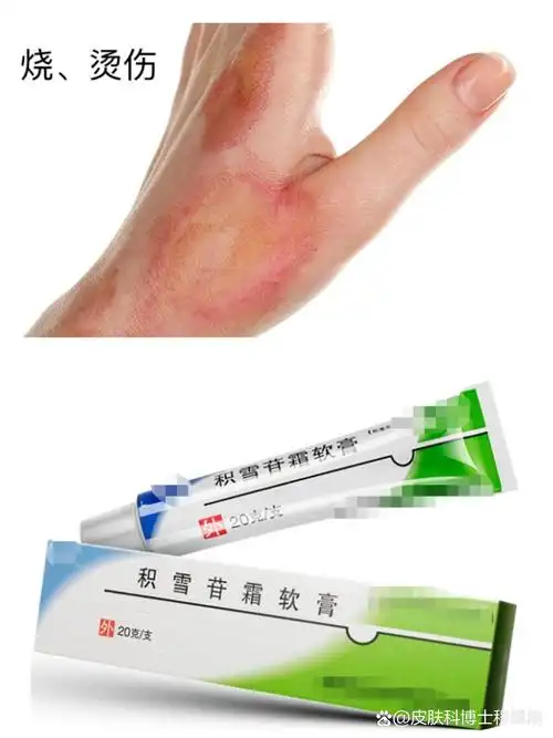 【皮肤科医生的秘密武器:提升颜值的3款皮肤药膏】皮肤科医生私藏,让