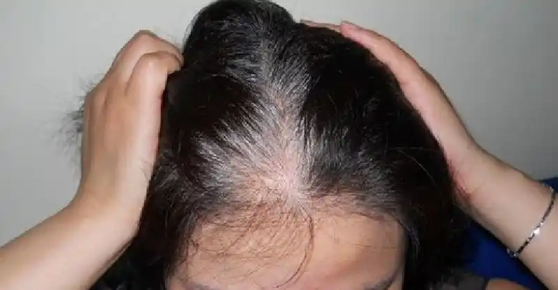 白头发长在哪,病就出在哪?2味中药,补虚乌发,从此告别白发