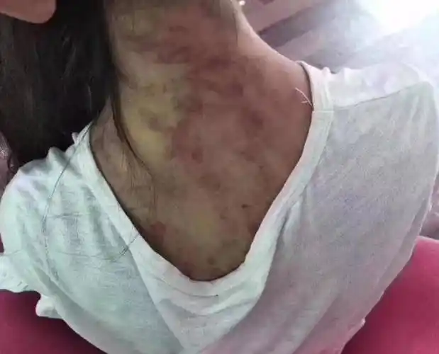 青海妈妈燕志云:虐待6岁女儿致死,7年后出狱,挖出女儿骨灰泄愤