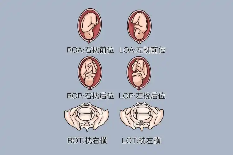 32周头位的胎儿姿势图