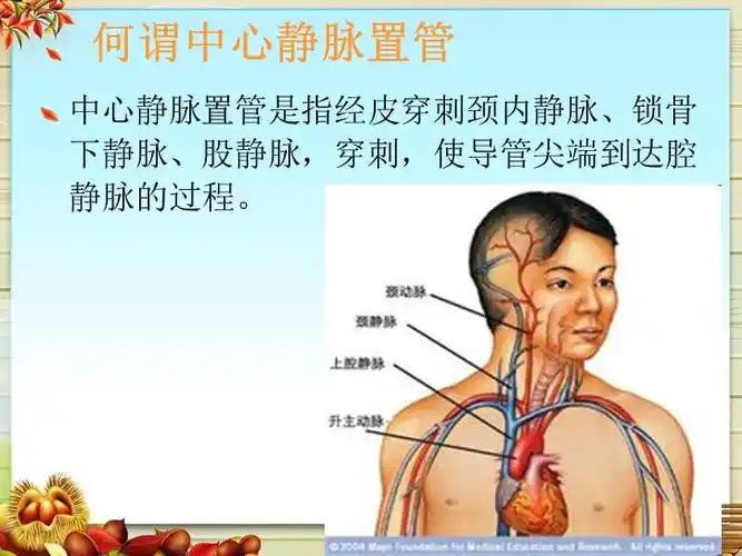 中心静脉的导管常见并发症的护理