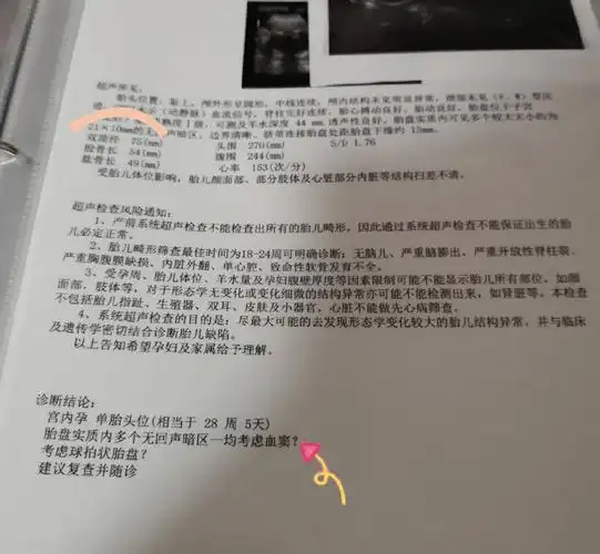 每次产检都有新知识:胎盘血窦给我退92