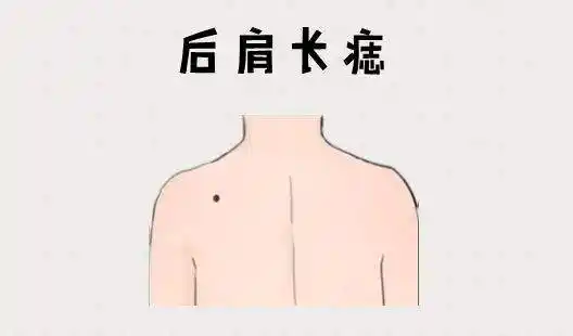 有这三颗痣财富跑不了(3颗发财痣)_竞价网