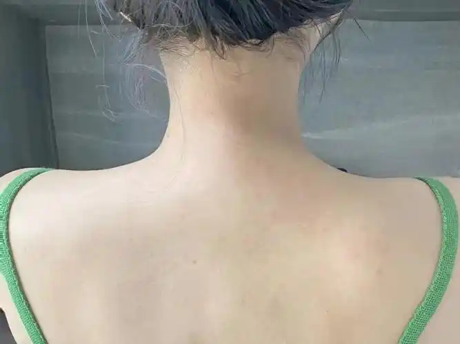 过来人三个建议!粗糙皮肤也能恢复光滑细嫩!_腾讯新闻