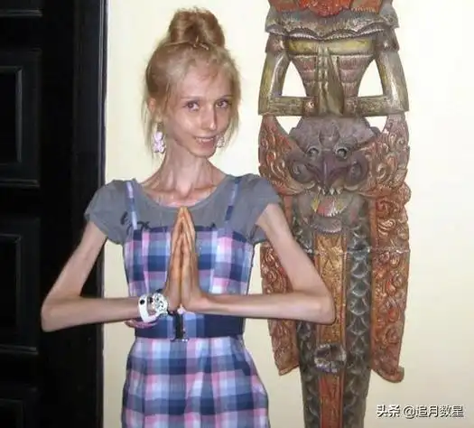 世界上最瘦的女人:活的骷髅美女,风一吹就"酥化"了