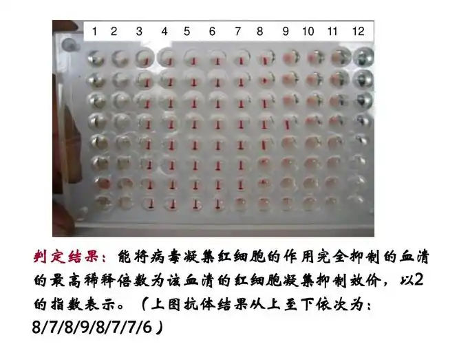 2 3 4 5 6 7 8 9 10 11 12 判定结果: 判定结果:能将病毒凝集红细胞的