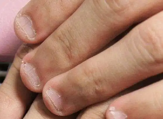 孩子从小"啃手指",长大后怎么样了?多半是这3个结局