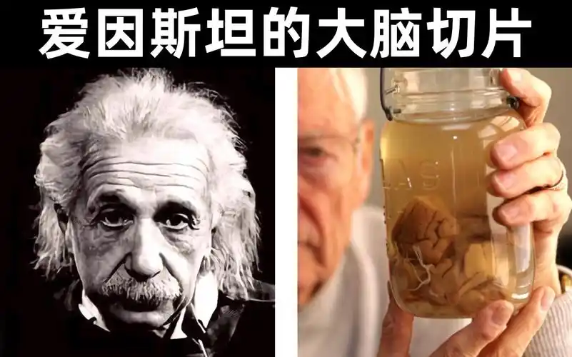 他偷走爱因斯坦大脑切成240块,发现聪明的真相 | 学习力的差异到底在