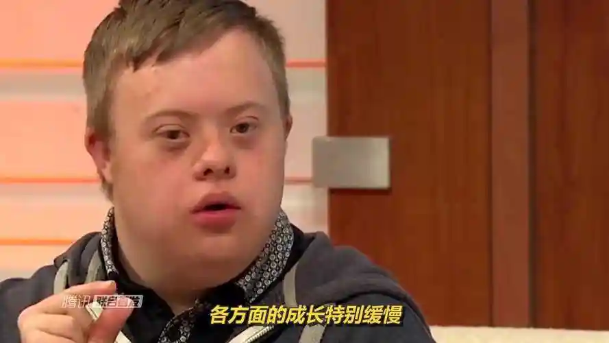 为什么唐氏综合征患者大部分都长得一样看完难以接受