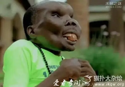 世界上最恶心的人,又丑又恶心的男人和女人(图片)