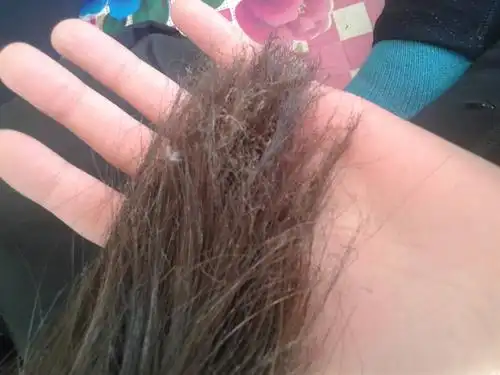 我的头发被火烧焦了,一打开全是勾勾,请问一下,我不想剪掉,什么方法能