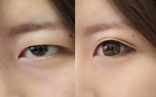 单眼皮|内双|睫毛_网易订阅