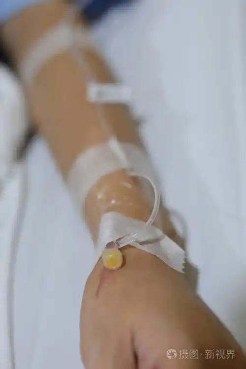 卧床病人静脉输液静脉注射照片-正版商用图片26dzry-摄图新视界