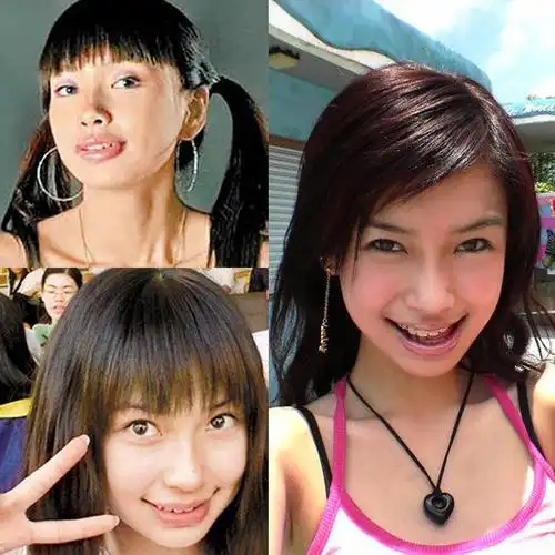 正文baby一直被认为是整形成功的女星之一   关于女星是否整容的话题