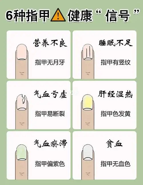 观指甲,辨健康||6种指甲"异常"的成因_身体健康_倒刺_健康知识科普