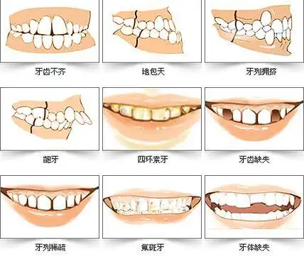 项目中心 > 牙齿修复_武汉爱齿尔口腔