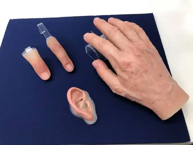 精细到指纹结构光学扫描让义肢成真