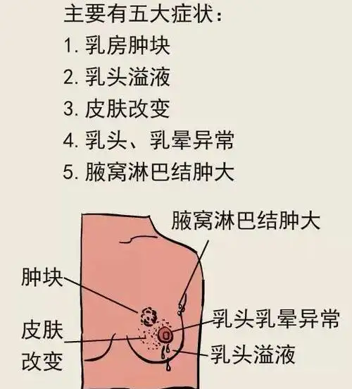 皮肤改变:皮肤粘连(酒窝征),皮肤红肿(炎性乳癌),皮肤水肿(橘皮征).