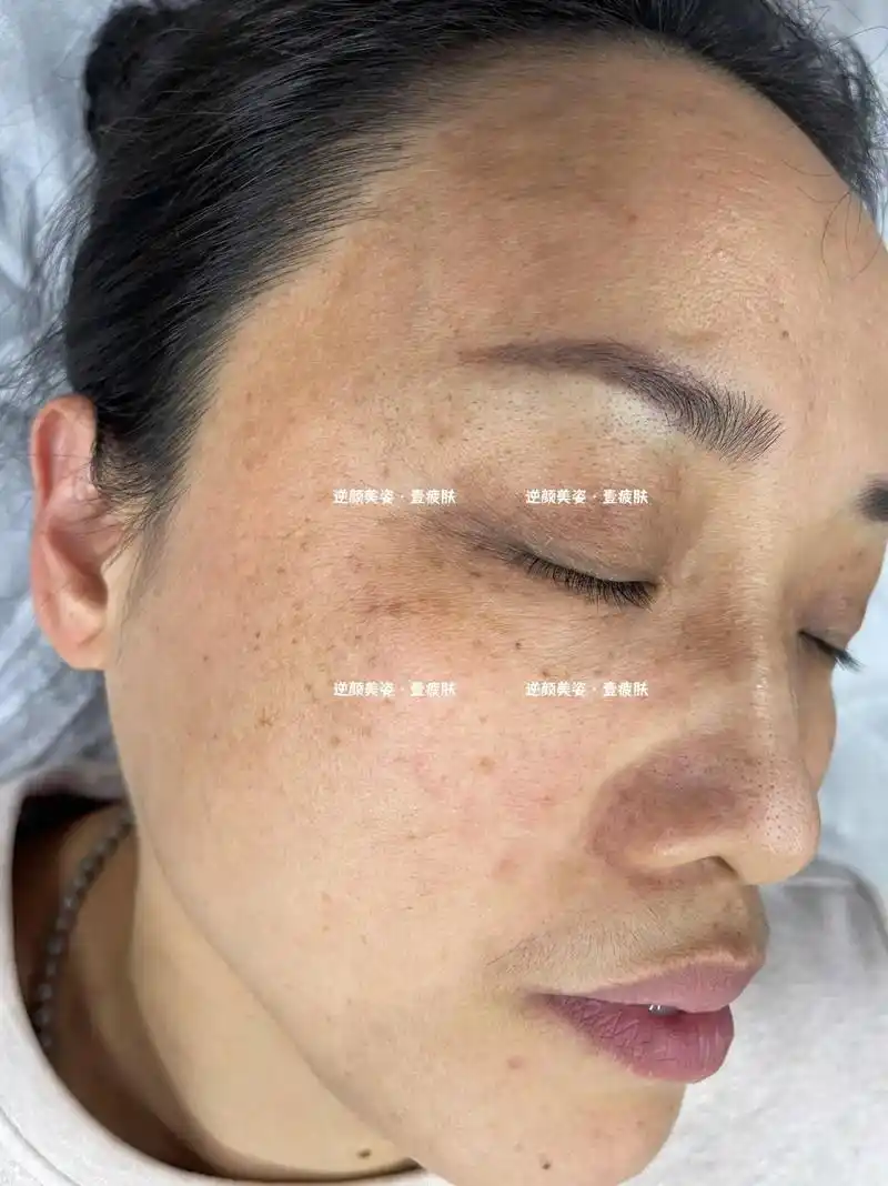 问题性皮肤终点站 #不辜负每一份信任 #女人一定要活成自己 - 抖音