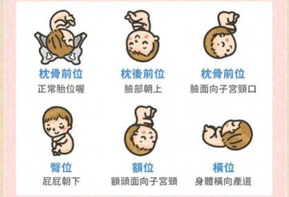 而难产对于胎儿及妈咪的生命都会是严重的威胁,下面当妈咪查出胎位不