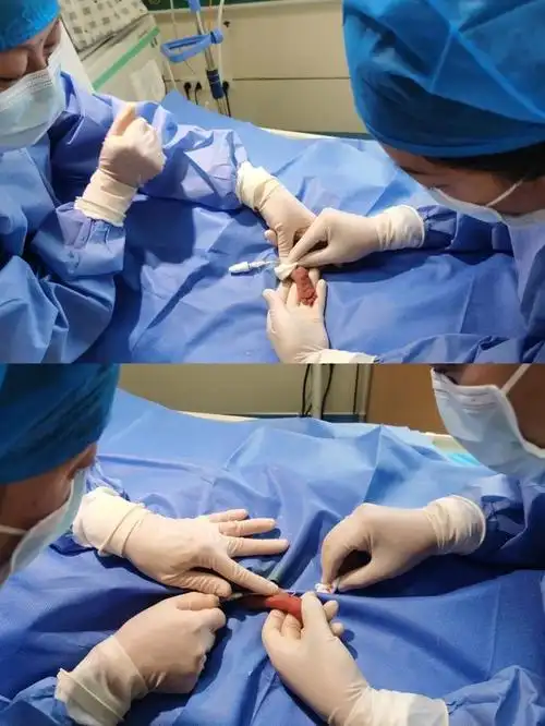 揪心开封这个胎龄仅253周的极早早产儿