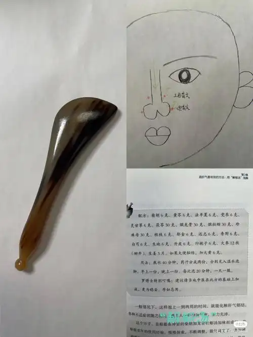 面部刮痧淡斑祛斑鼻梁中间的黄褐斑