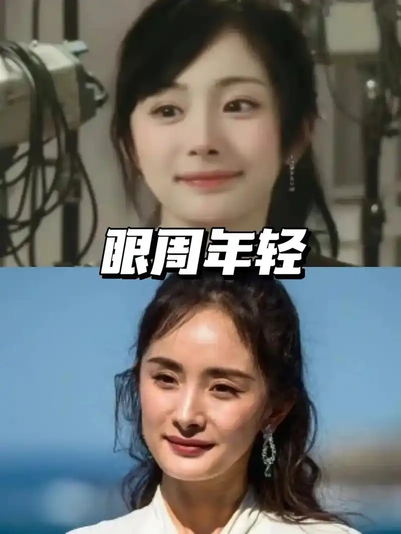 为什么年纪越大,眼周越显老.生完娃后的杨幂,老的最快的就是眼 - 抖音