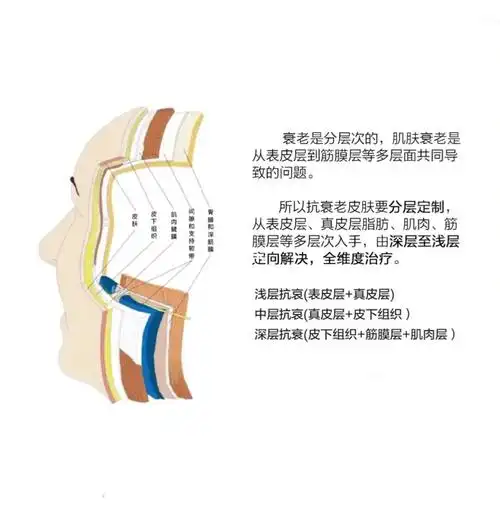 分层抗衰主要是针对皮肤表层以及真层和筋膜层做改善,使皮肤变得紧致