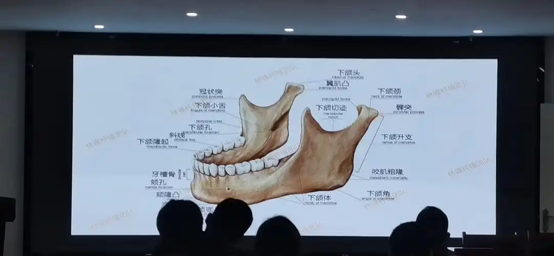 关于解剖结构 上颌骨