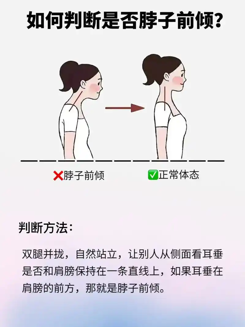 养成气质好体态～#抖音图文来了 #体态纠正 #脖子前倾 #含 - 抖音