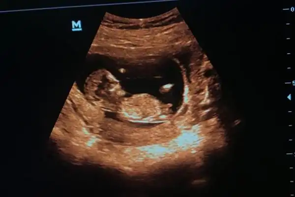 nt图弯着就是男孩平是女孩nt躺着的女孩居多2