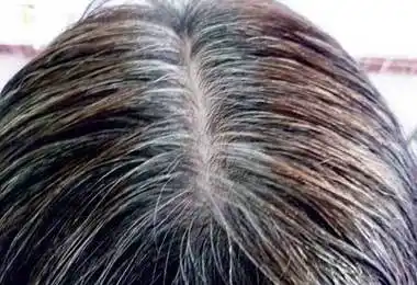 白发变黑有妙招!啤酒加它就是天然乌发剂,洗完3天乌黑又亮丽