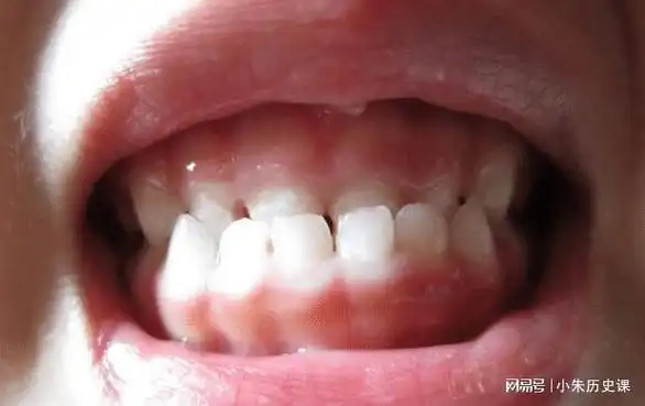 宝宝地包天, 除了父母遗传, 还可能是生活中这4个坏习惯引起的