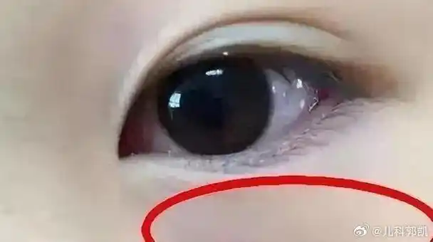 国医的精诚力量##儿童健康守护者计划##脾胃虚弱