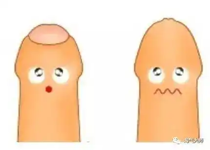 包茎分为 生理性和 病理性两种