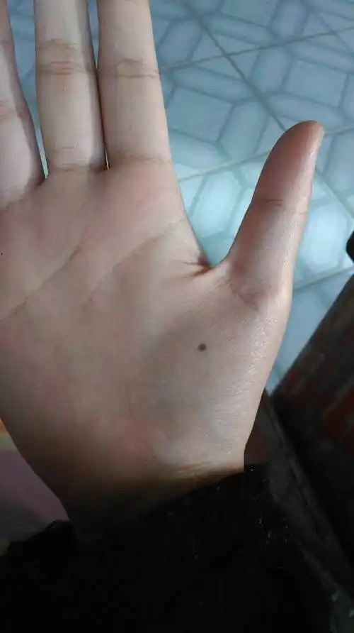 右手背有痣的女人代表什么