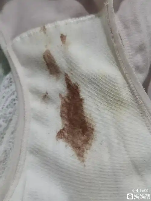 可以略带黄色,并且在月经前,排卵期,妊娠期有所增加如果白带有异常,多