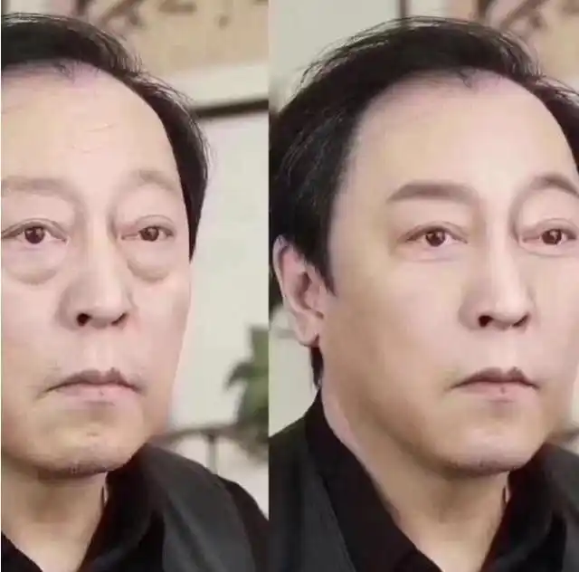 郭京飞割眼袋上热搜,堪称"精致老男孩"的翻身,网友却斥其不孝