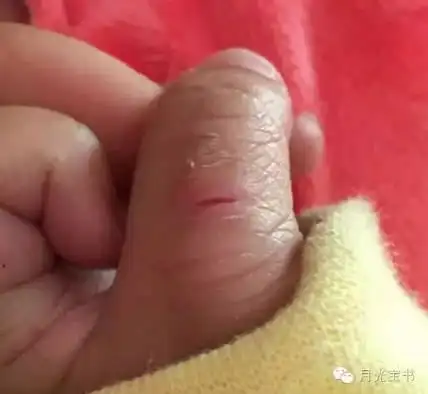 宝宝吃手吃到变形怎么办父母必须要了解的口欲期