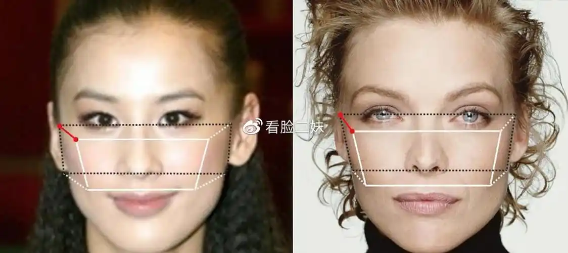 图解对比,让你三分钟知道颧骨高和颧骨外扩的区别是什么?