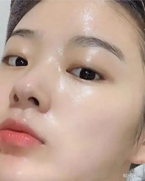 如何改善脸上皮肤特别薄一直泛红毛孔粗大红血丝明显