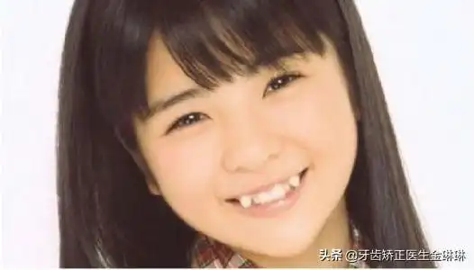 虎牙是怎么形成的