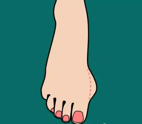 揭秘大脚骨不为人知的危害